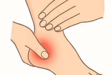 Achilles Tendinitis